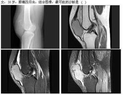 2013年高级卫生专业技术资格考试放射医学强化练习题及答案解析（1月30日·放射卫生技术服务专题）